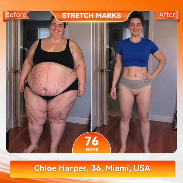 CUSIJAS® Moringa & Berberine 4-In-1 Micro-Particle Sculpting & Fat-Burn Shorts