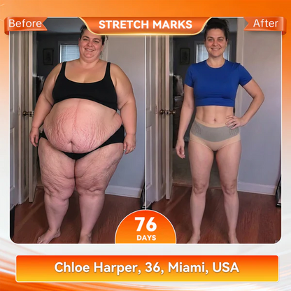CUSIJAS® Moringa & Berberine 4-In-1 Micro-Particle Sculpting & Fat-Burn Shorts