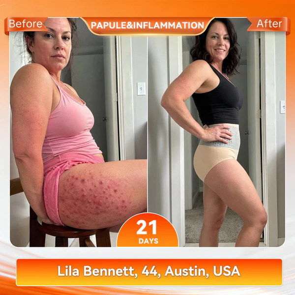 CUSIJAS® Moringa & Berberine 4-In-1 Micro-Particle Sculpting & Fat-Burn Shorts